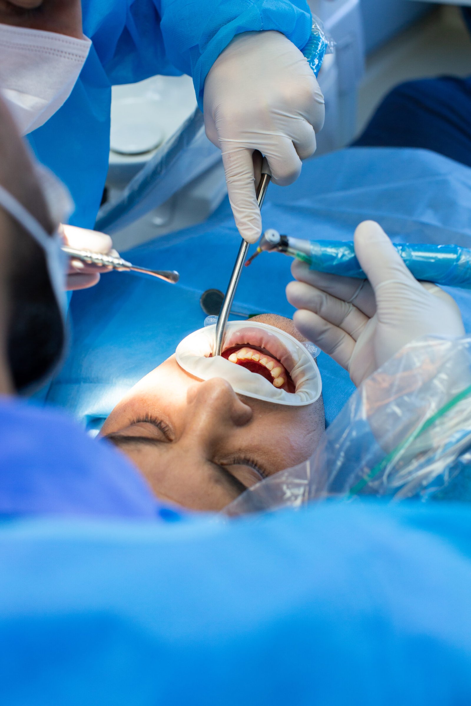 Dentista realizando tratamento de canal com cuidado